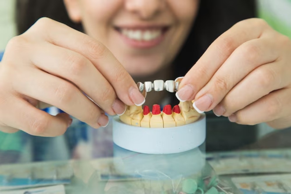How Do Dental Bridges Replace Missing Teeth